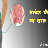 फिस्टुला के घरेलू उपचार और 7 चौंकाने वाले तथ्य | भगंदर ठीक कैसे करें?