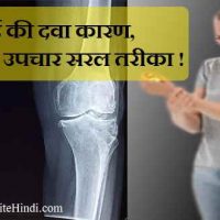 जोड़ों में दर्द की दवा कारण, लक्षण और उपचार हिंदी में !