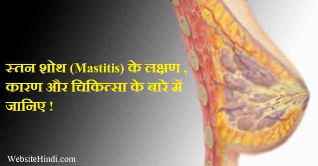 Mastitis treatment hindi