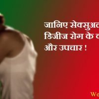 रतिजन्य रोग (Sexually Transmitted Diseases) क्या है? कारण, बचाव और ट्रीटमेंट के बारे में जानकारी |