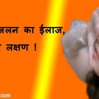 आंखों में जलन (Aankhon Mein Jalan) का ईलाज, कारण और लक्षण !