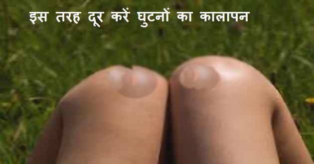 घुटनों-का-कालापन