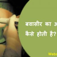 बवासीर का ऑपरेशन कैसे होती है?